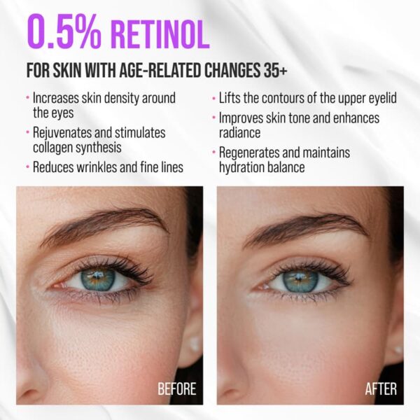 Silmaümbruskreem 7DAYS MY BEAUTY WEEK RETINOL “RE-FRESH” jahutava keraamilise aplikaatoriga. Retinooli ja hüaluroonhappe rekordiliselt kõrge kontsentratsioon tagab: • Vananemisvastase toime. Retinool minimeerib peened jooned ja kortsud, indutseerib rakkude uuenemist, suurendab kollageeni tootmist ja naha elastsust. • Niisutuse. Hüaluroonhape niisutab, värskendab ja silub nahka intensiivselt ning taastab hüdrolipiidide tasakaalu, muudab naha elastseks ja silub kortse. • Lifting efekti. Kreem võitleb tumedate silmaaluste ja väsimusjälgedega. “RE-FRESH” jahutav metallist aplikaator eemaldab tursed, lõdvestab lihaseid, aitab parandada mikrotsirkulatsiooni ja süvendada aktiivsete komponentide läbitungimist. Puhastage nahka tavalise näopuhastusvahendiga.