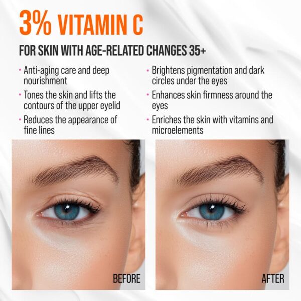 Silmaümbruskreem 7DAYS MY BEAUTY WEEK VITAMIN C “RE-FRESH” jahutava keraamilise aplikaatoriga. Rekordiliselt kõrge C-vitamiini ja õli kompleksi kontsentratsioon annab: • Lifting efekti. Kreem võitleb tumedate silmaaluste ja väsimusjälgedega. • Sära. C-vitamiin taastab ja helendab teie nahka, on võimsa antioksüdantse toimega, võitleb pigmendilaikudega ja takistab nende tekkimist. • Nourishing Oil kompleks küllastab nahka niiskusega, tugevdab seda, muudab selle elastseks ja silub kortse. “RE-FRESH” jahutav metallist aplikaator eemaldab tursed, lõdvestab lihaseid, aitab parandada mikrotsirkulatsiooni ja süvendada aktiivsete komponentide läbitungimist. Puhastage nahka tavalise näopuhastusvahendiga